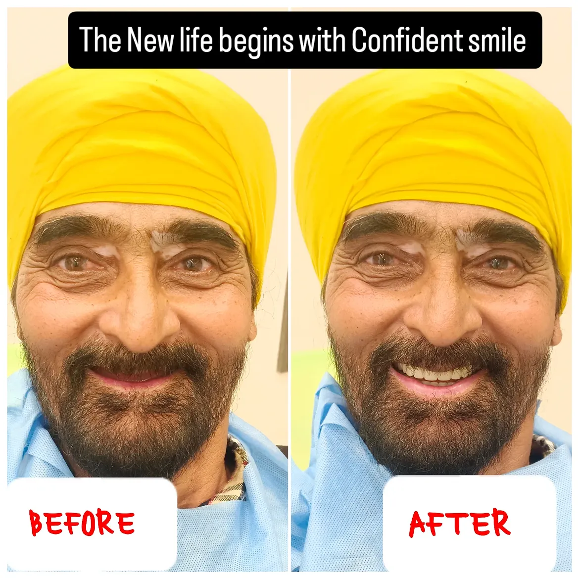 The New Life begins with Confident smile 😁